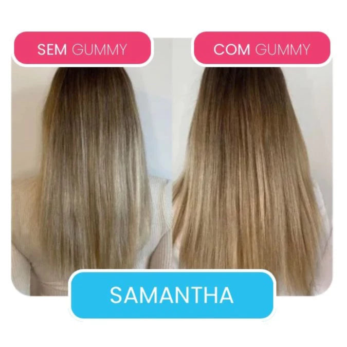 VittaControl Gummy ZERO Kit 3 meses de Vitaminas para Cabelos, Unhas e Pele - O melhor do Brasil